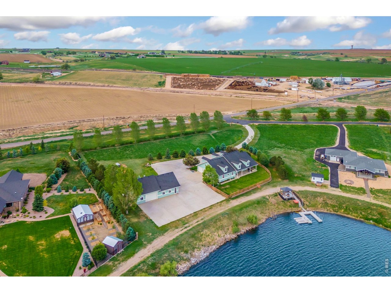 Cannot develop around the lake at all. 